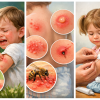 Piqûre d'insecte chez l'enfant : que faire ? Le guide complet des pharmaciens