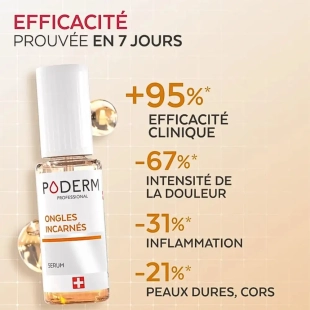 PODERM - Sérum Ongles Incarnés - Soulage la Douleur - Flacon de 8ml