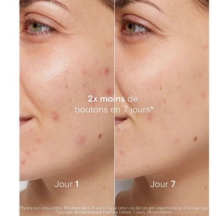 La Rosée coffret idée cadeau beauté anti-imperfections Duo Visage Peau Nette gel nettoyant gel-crème hydratant et serviette visage offerte